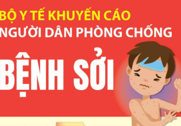 NHỮNG ĐIỀU CẦN BIẾT VỀ BỆNH SỞI VÀ CÁCH PHÒNG, CHỐNG BỆNH.